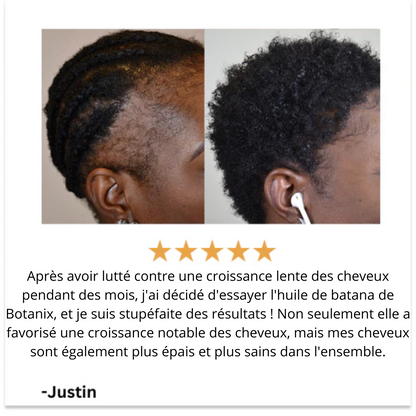 Batana - Huile Naturelle Pour la Croissance des Cheveux